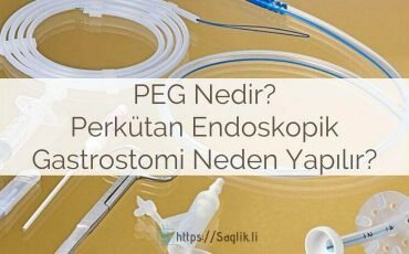 PEG nedir? Perkütan endoskopik gastrostomi nedir? Nasıl takılır, bakımı, besleme